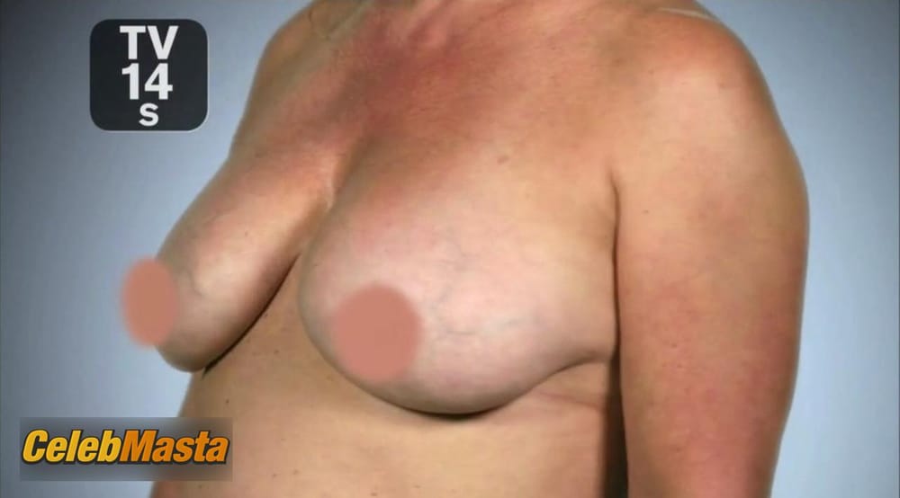Photo Gallery: Nicole Eggert in Botched photo 1
