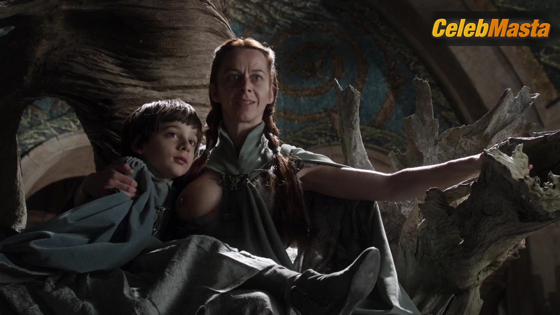 Kate Dickie ’s Prosthetic Scene From Game Of - Photo 2 of 5